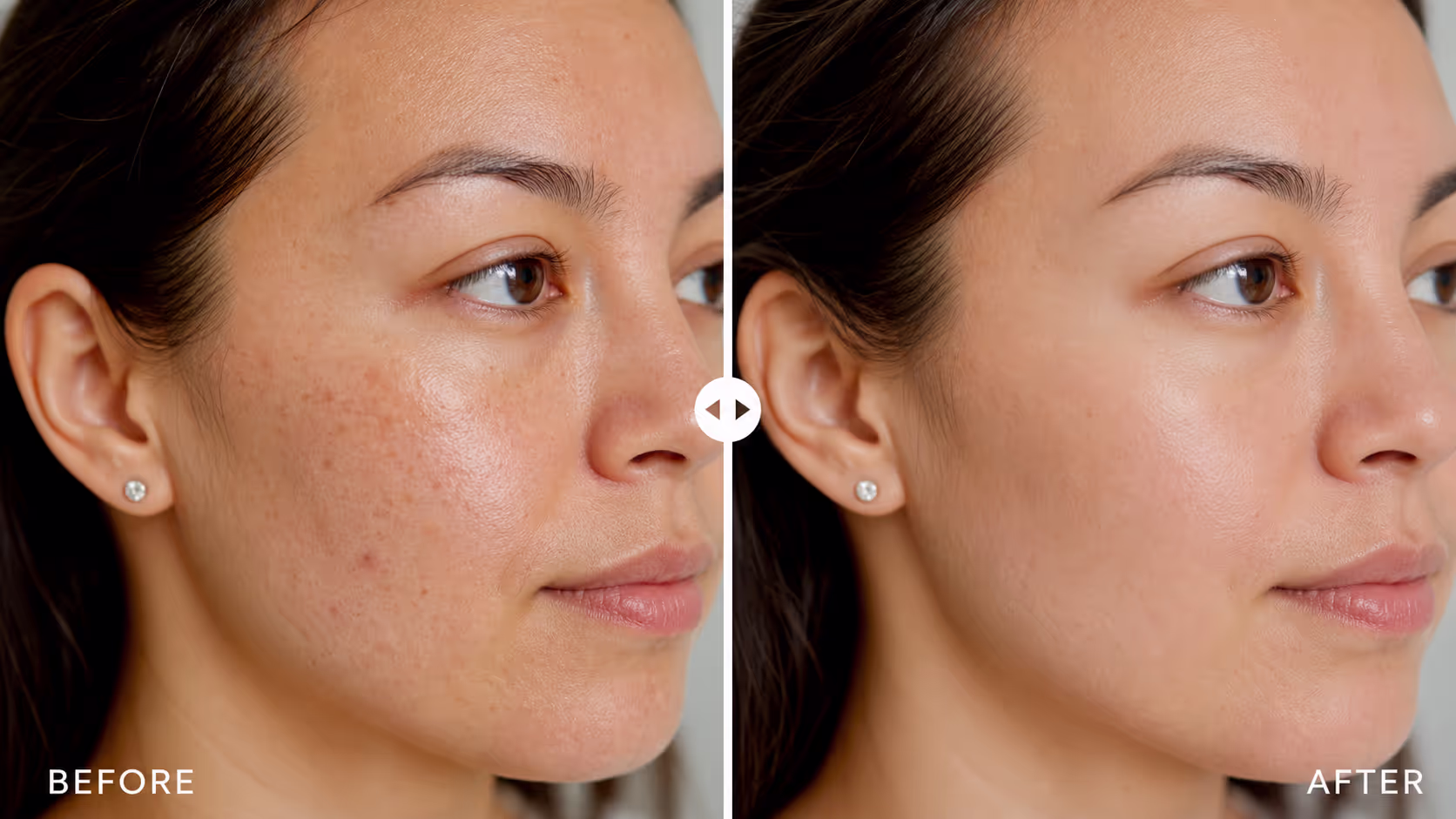Skincare progress