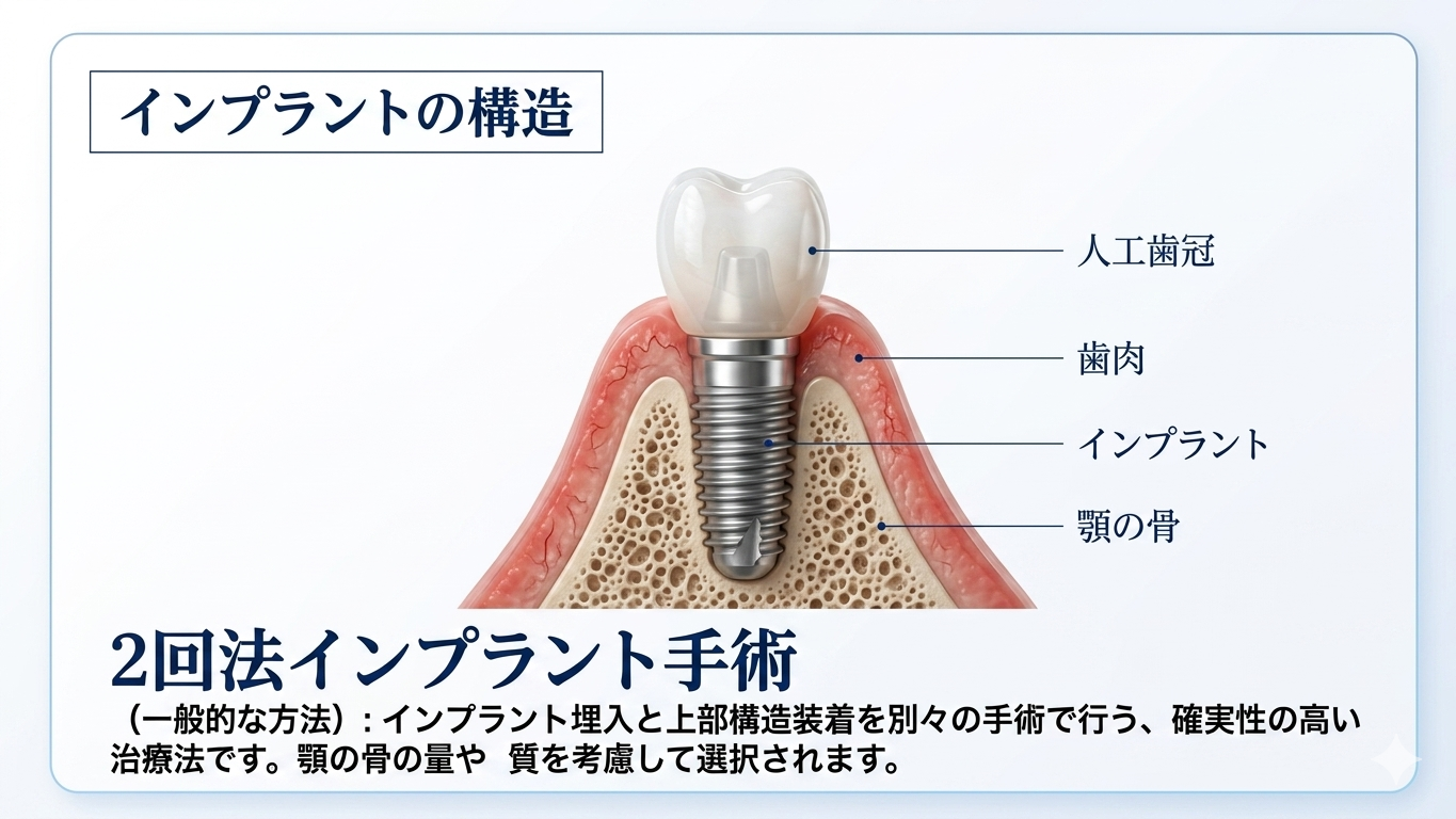 インプラント2回法の流れ(CTによるインプラント診断に基づく治療計画)