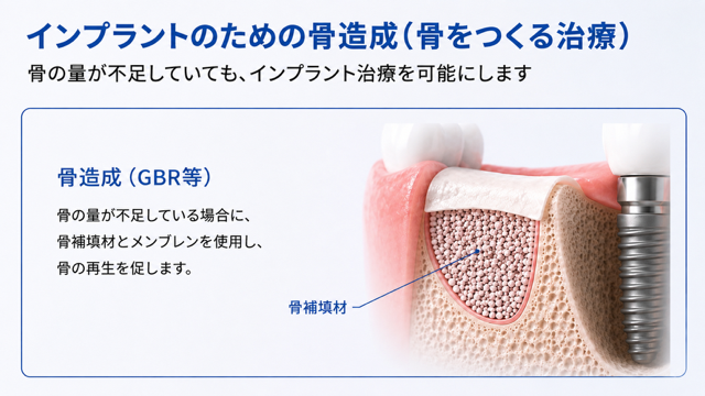 骨造成（GBR）の説明図